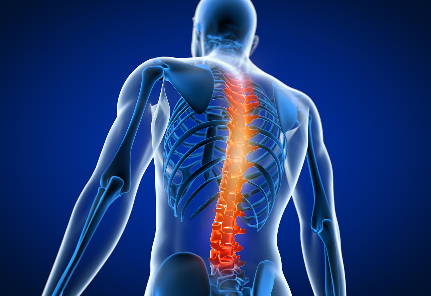 Chiropractors for Auto Accident Injuries - Call 1-855-58-WRECK (97325)